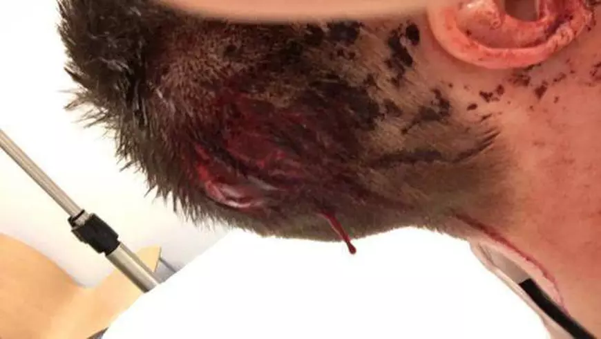 Stuttgart l-a dat afară pe Grosskreutz! Neamțul a fost la bordel împreună cu trei juniori ai șvabilor