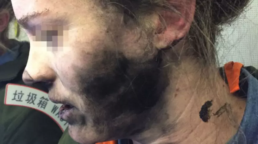 O femeie a fost rănită de căștile sale, care au explodat în timpul unui zbor