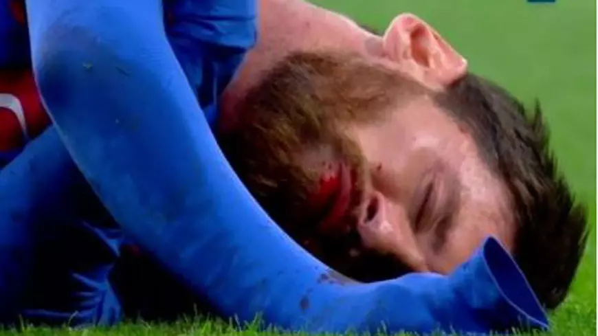 Real - Barcelona 2-3. Umplut de sânge, Messi a adus victoria ”extratereștrilor” la ultima fază și a marcat golul 500 pentru Barca / VIDEO