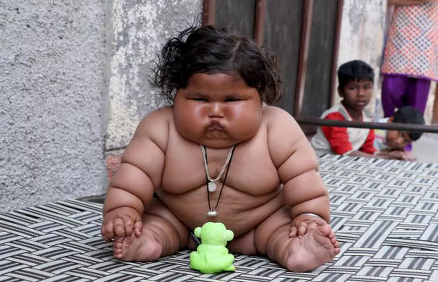Bebeluș obez în India. La opt luni, o fetiță cântărește 17 kilograme