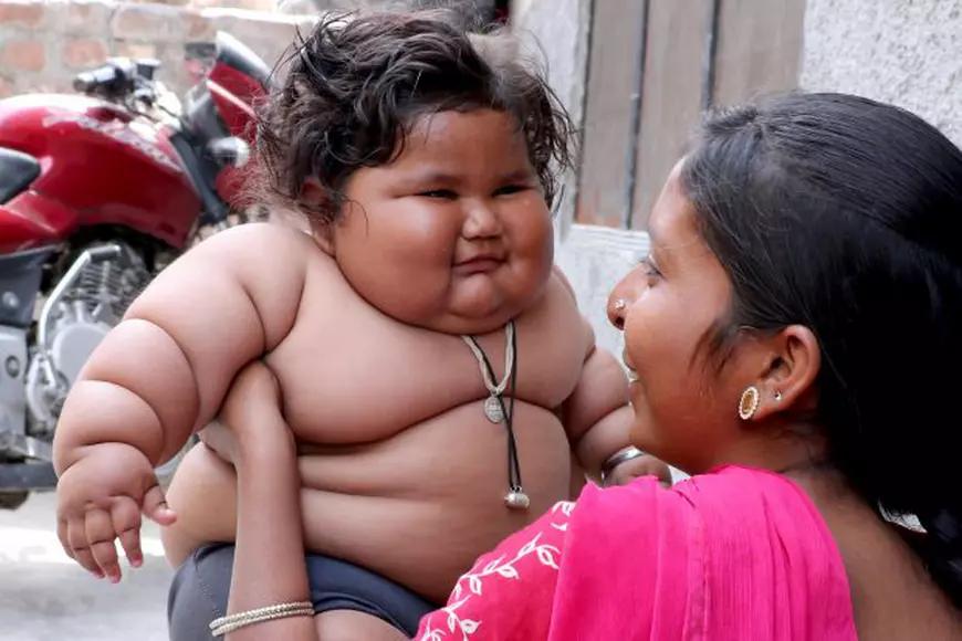 Bebeluș obez în India. La opt luni, o fetiță cântărește 17 kilograme
