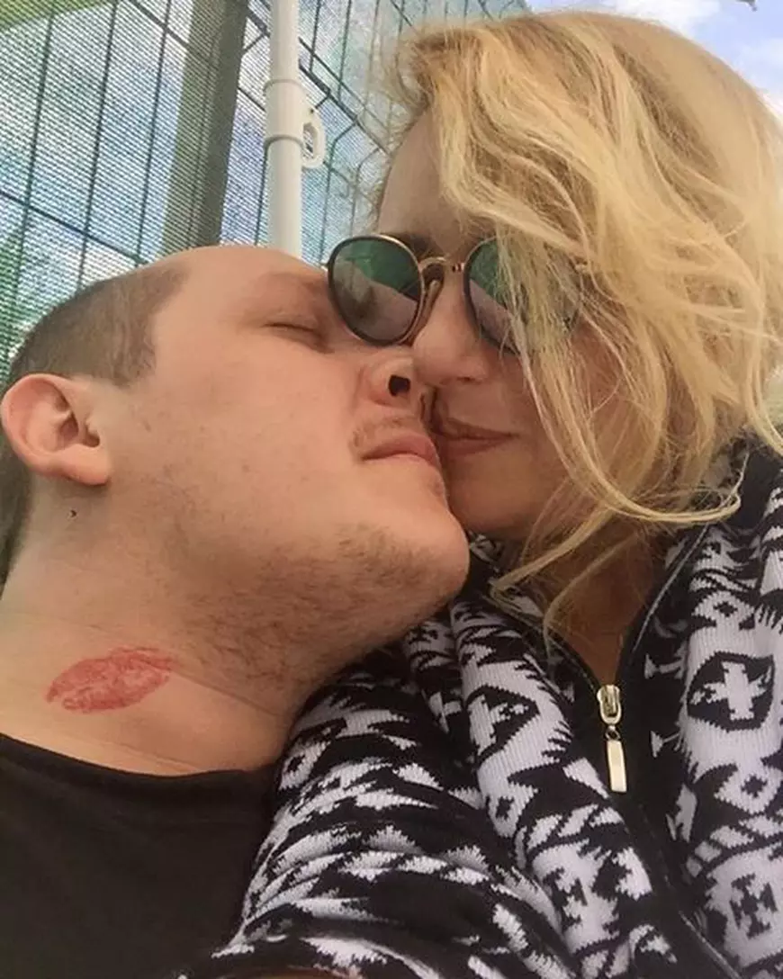 EXCLUSIV/ De ce nu renunță What’s Up la șepci și pălării. Își pregătește chelia pentru un implant de păr