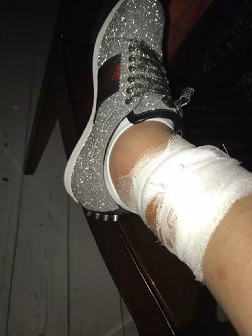 EXCLUSIV/ De la bal, la spital! Adrian Minune a ajuns la Camera de gardă după ce a fost mușcat de un picior