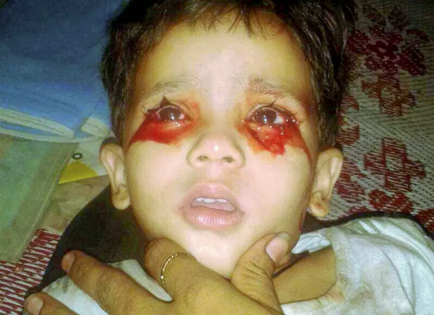 Caz șocant: O fetiță de trei ani plânge cu lacrimi de sânge. Medicii nu știu de ce boală suferă