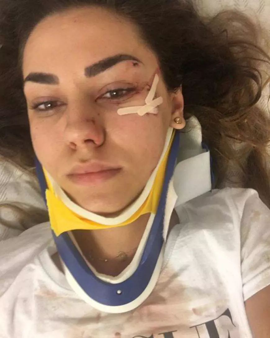 Mama Mirei de la Dj. Project, declarații cutremurătoare după accident. “Avea cioburi în față. M-a sunat și mi-a zis…”