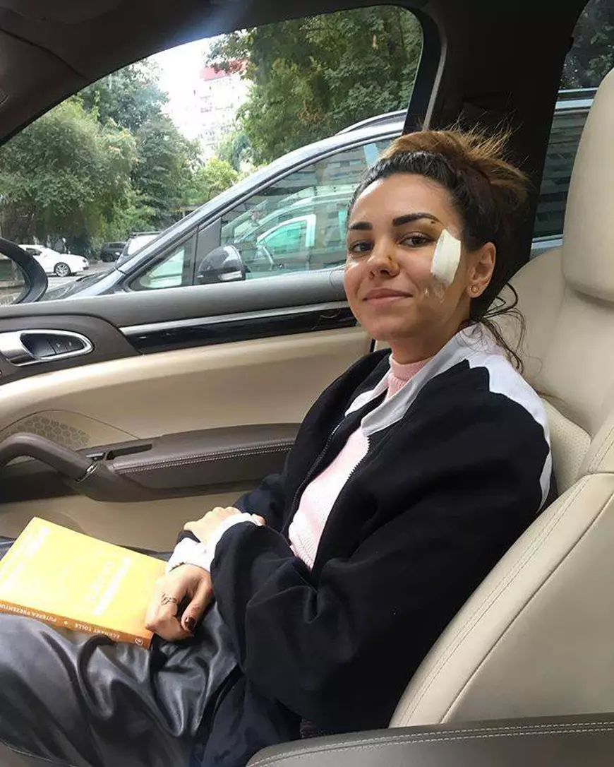 Mira a fost externată. Cum arată artista după accidentul în care au fost implicați membrii trupei Dj Project