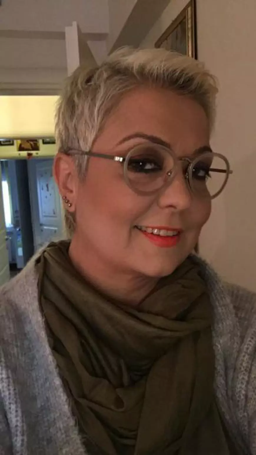 Monica Anghel s-a schimbat total după operația la coloană. Artista are parte de o recuperare dureroasă