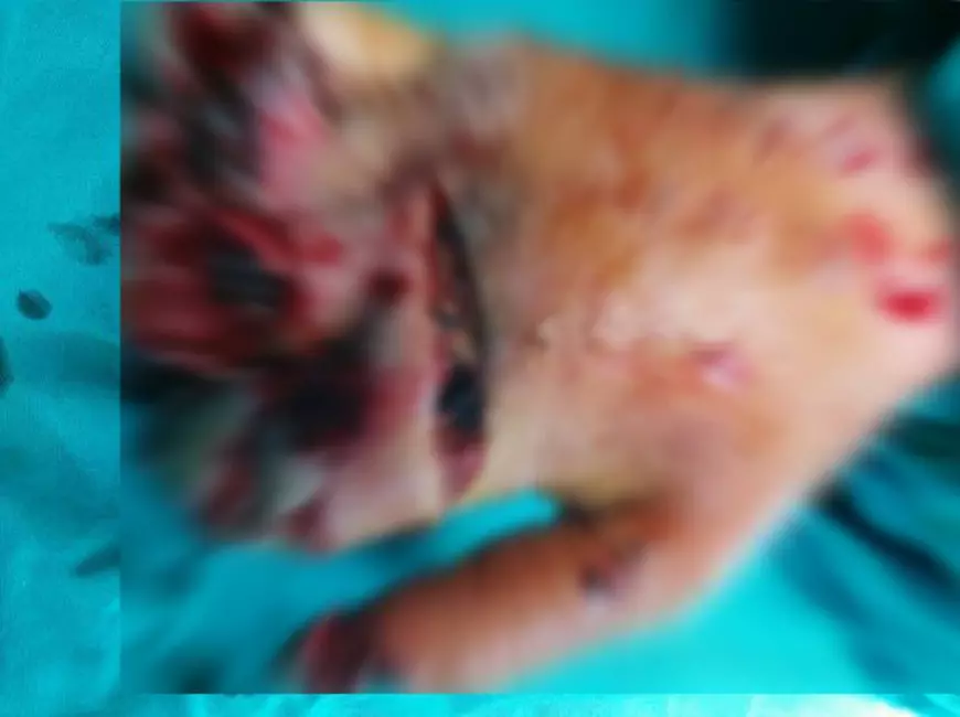 Mesajul medicului Dan Grigorescu din Brașov, despre lipsurile din sistemul sanitar. A chemat asistenta de acasă pentru a opera o femeie cu mâna distrusă de un tocător