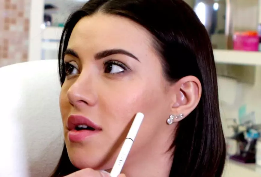 FOTO EXCLUSIV/Nicoleta Nucă a scăpat de cicatricea care o chinuia de 24 de ani. ”Putea să se extindă pe jumătate de față”