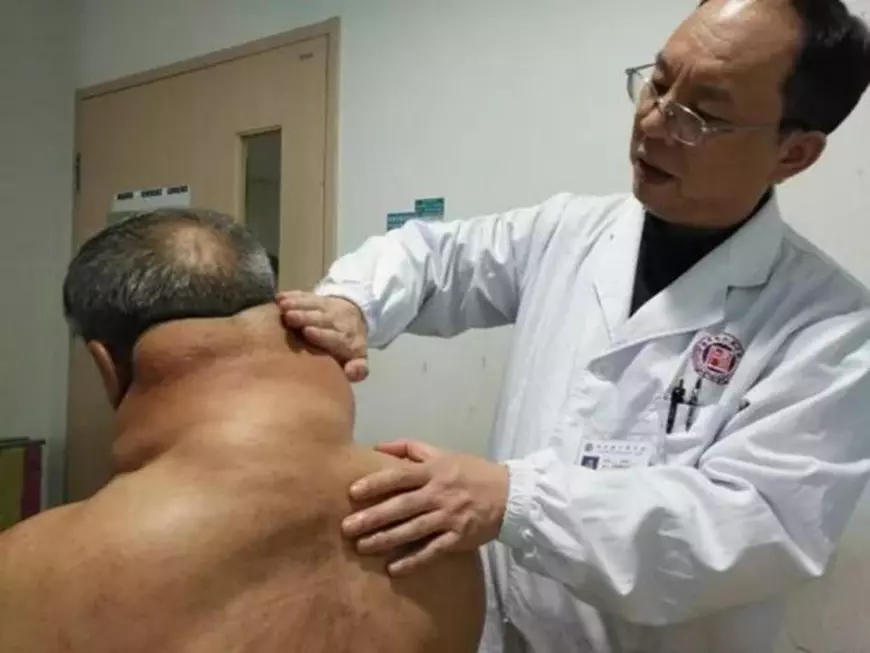 FOTO | Cum arată "Hulk", un pensionar care a consumat alcool în fiecare zi, timp de 30 de ani