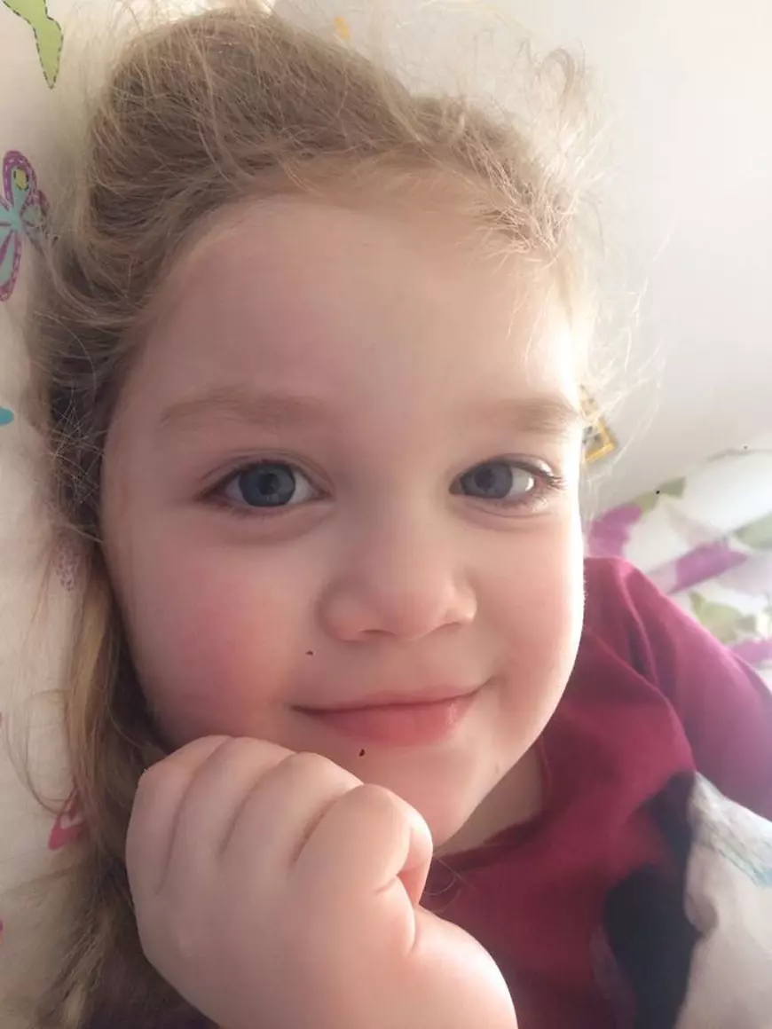 A cincea operație pentru Teodora. Fetița suferă de nev congenital gigant din prima zi de viață și a fost operată în America