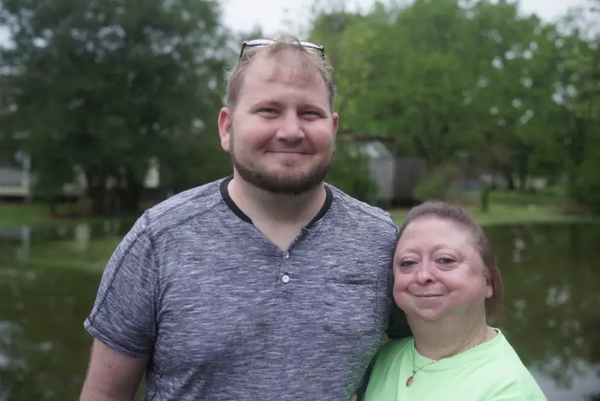 Femeia care la 30 de ani arată de 60. Este una dintre cele mai longevive bolnave de progeria din lume