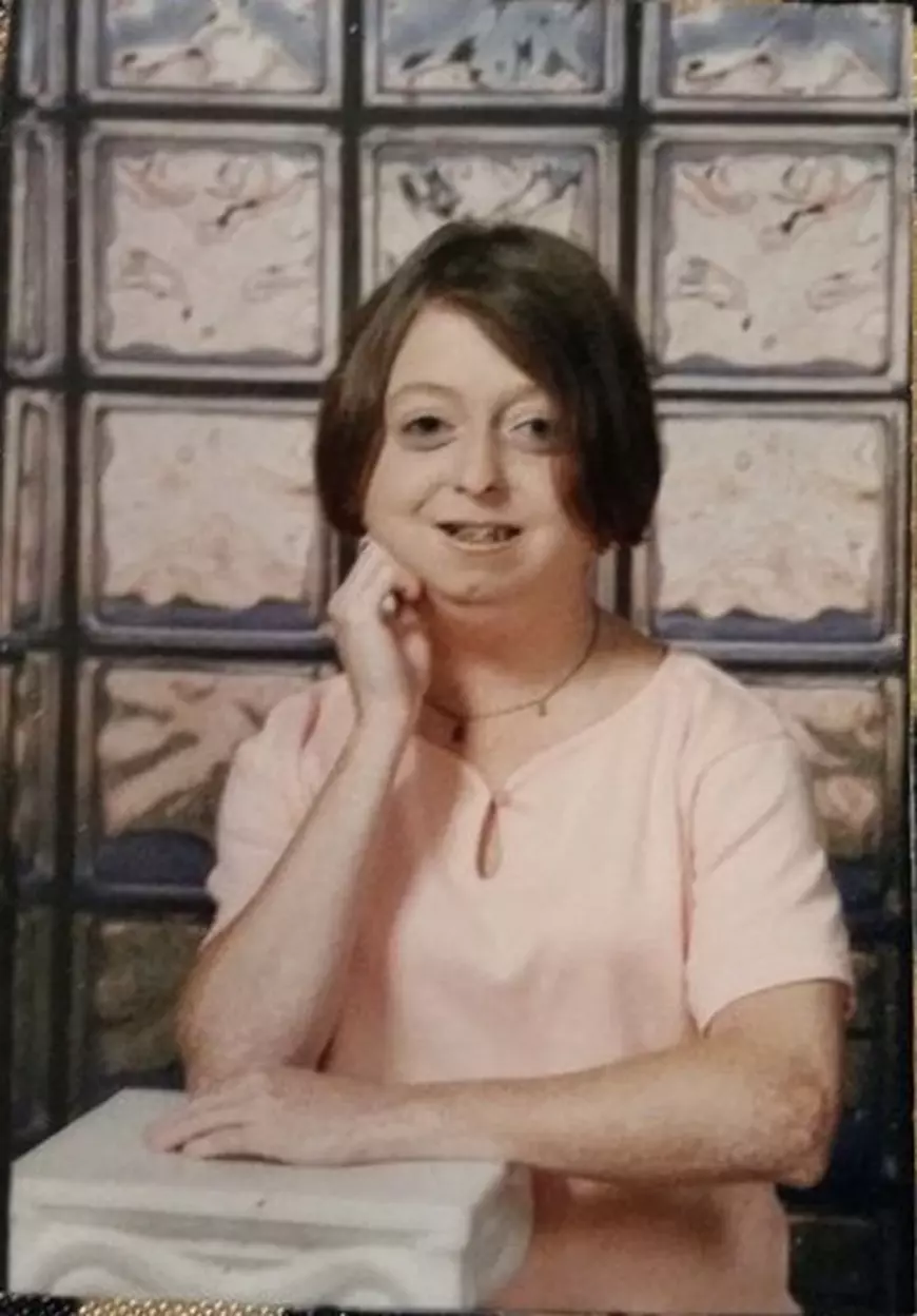 Femeia care la 30 de ani arată de 60. Este una dintre cele mai longevive bolnave de progeria din lume