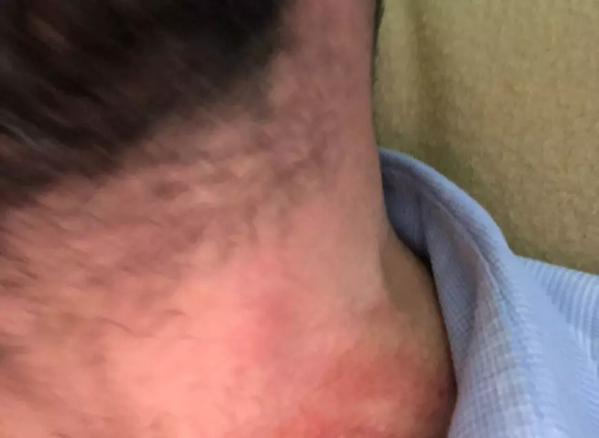 VIDEO&FOTO/ Șeful OPC Constanța și colegii săi, agresați pe o terasă din Neptun în timpul unui control. Poliția face anchetă