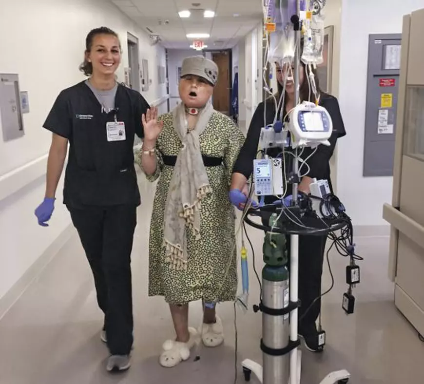 Katie, după transplantul facial (foto National Geographic)