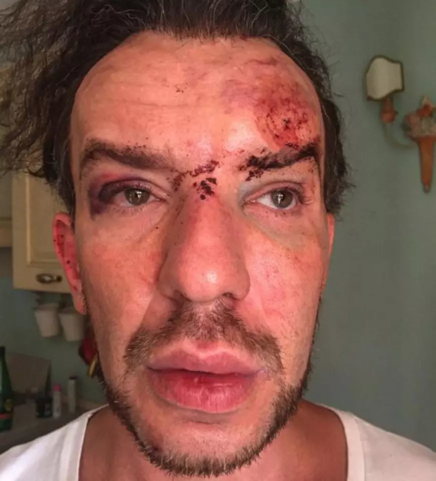 Celebrul designer Stephan Pelger, bătut și jefuit, la Cannes: "Sunt recunoscător că am supraviețuit după această tentativă de crimă"