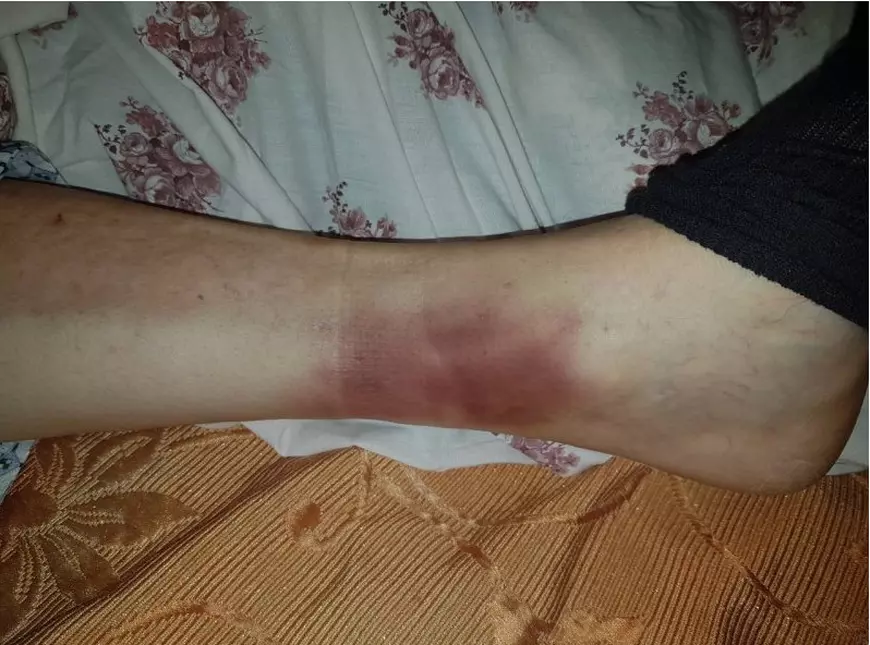Acuzații de rele tratamente la un spital din Iași. Fiica unui pacient de 78 de ani susține că a fost legat de pat și învinețit