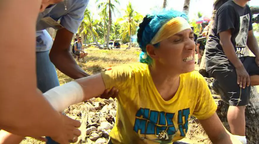 Sorana s-a accidentat la cap și la mâna dreaptă