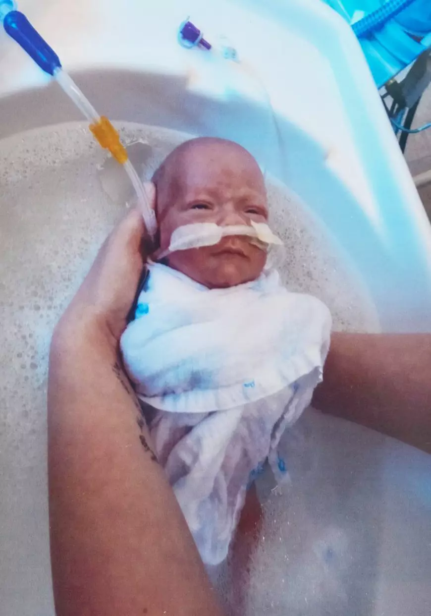 Cel mai mic copil născut în Marea Britanie. Un băiețel care cântărea cât o conservă la naștere a supraviețuit și după șase luni a fost externat