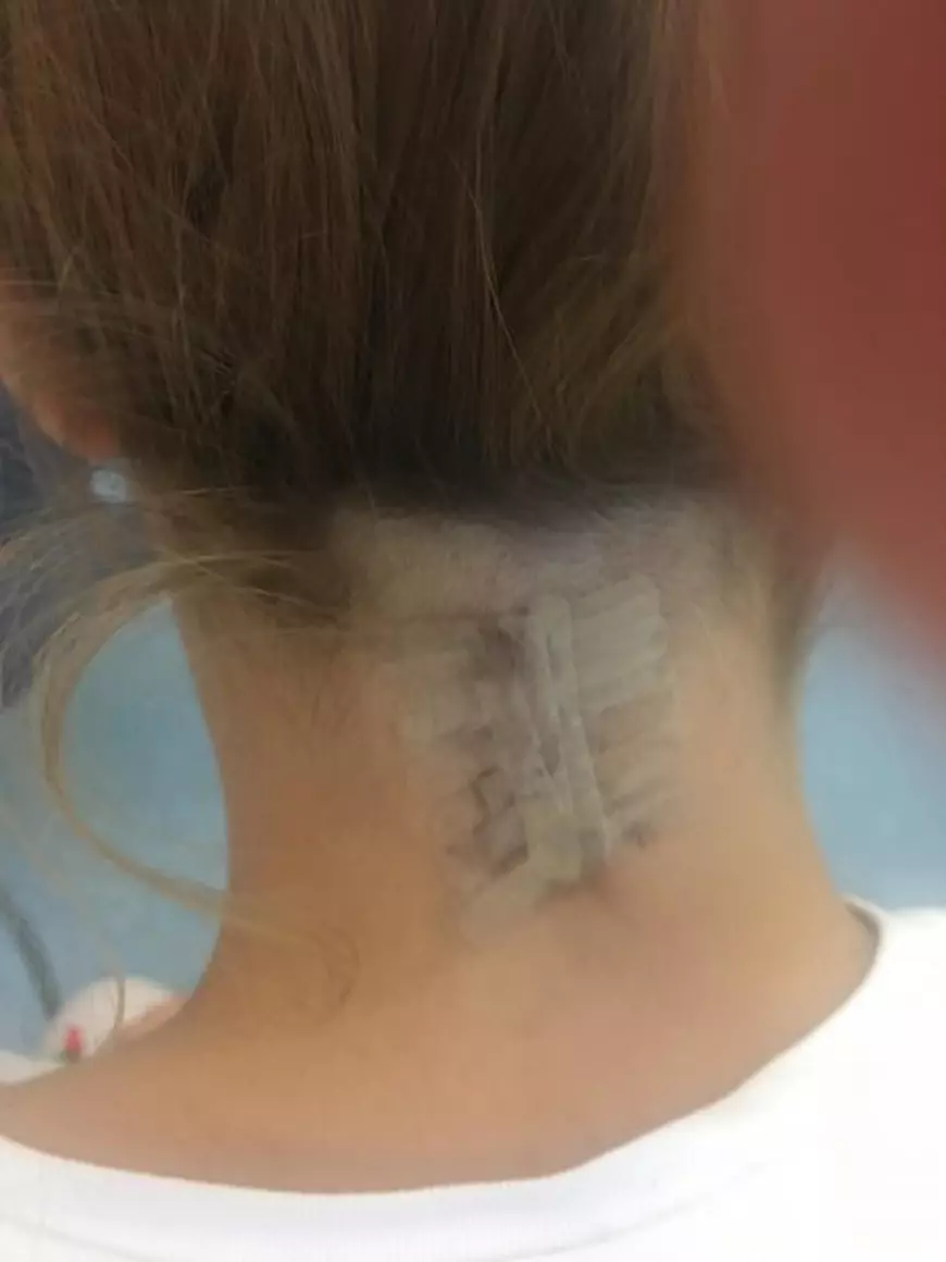 ACTUALIZARE / Handbalista Ada Iliescu are nevoie urgentă de 5.000 de lei. Sportiva nu mai aude cu urechea dreaptă