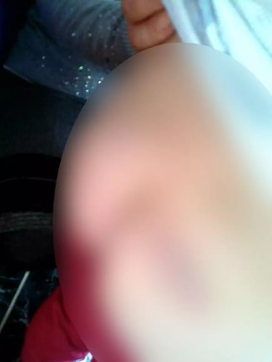 O fetiță de cinci ani a fost bătută cu bestialitate de o rudă care o avea în grijă, în Vrancea. Cum arată copilul