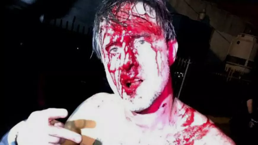 Actorul David Arquette, bătut măr într-un meci de wrestling. A ajuns la spital, la un pas de moarte, cu răni grave. Scene interzise minorilor | FOTO&VIDEO