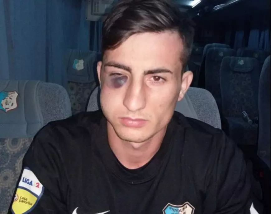 Cum se simte Denis Brînzan, căpitanul de la Pandurii, după accidentarea gravă de la Timișoara: ”Trebuie să facă trei operații”