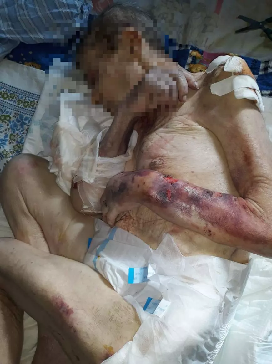 FOTO| Spitalul Pantelimon a externat un pacient aflat în stare critică. Imagini șocante cu femeia trimisă acasă, oferite de familie Libertății