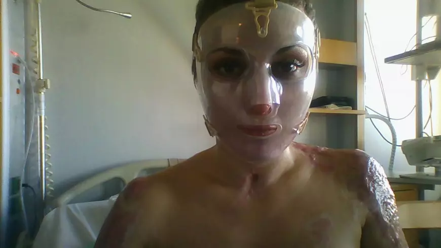 VIDEO/ Viața după Colectiv. Adina Apostol, supraviețuitoarea care a rămas în România să lupte! Mesaj puternic pentru români: „Un popor prost e mai ușor de condus. Mergeți la vot!”