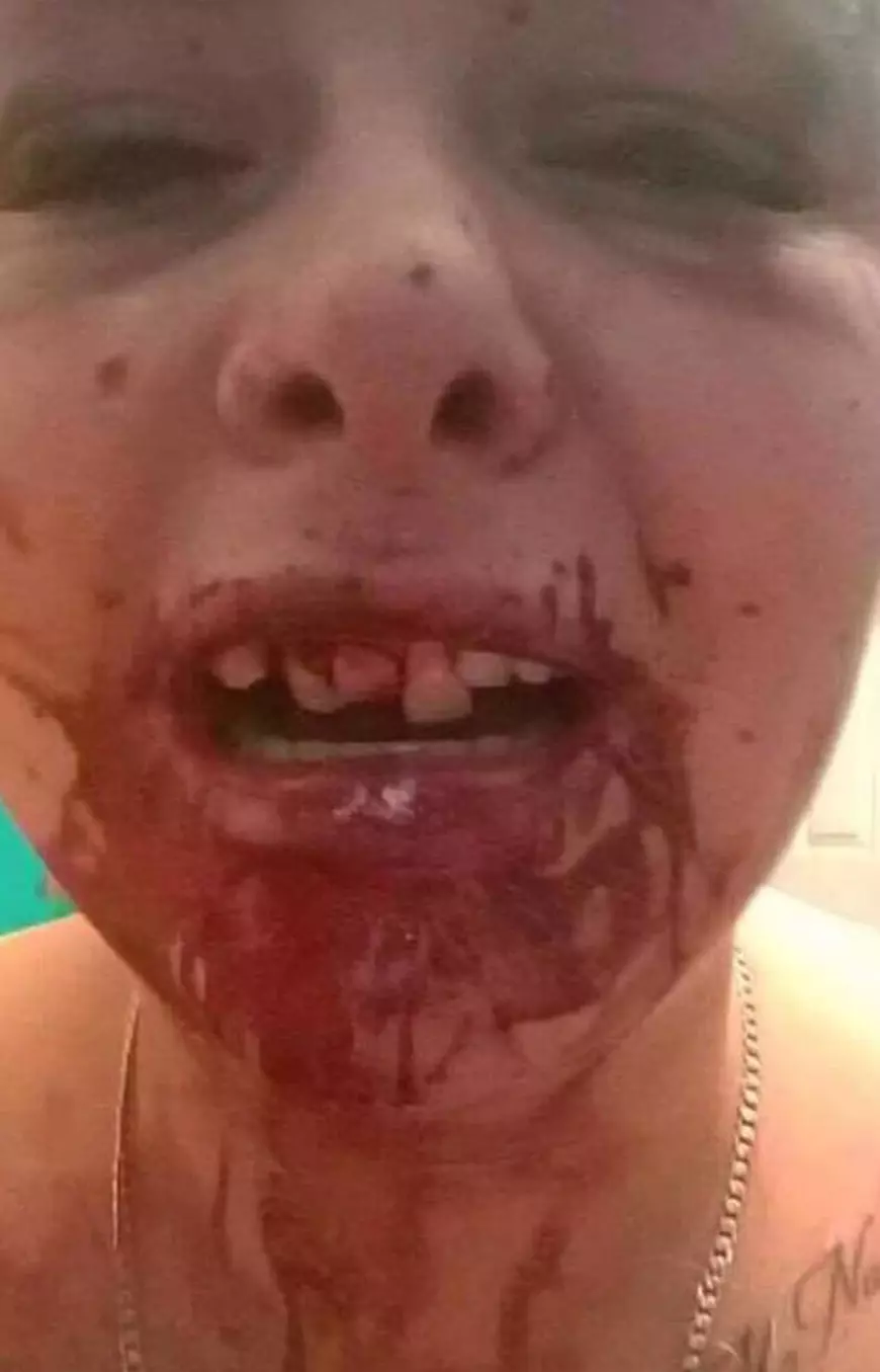 Un bărbat și-a bătut iubita și i-a spart trei dinți din cauză că a schimbat poza de pe Facebook și el nu mai apărea în ea