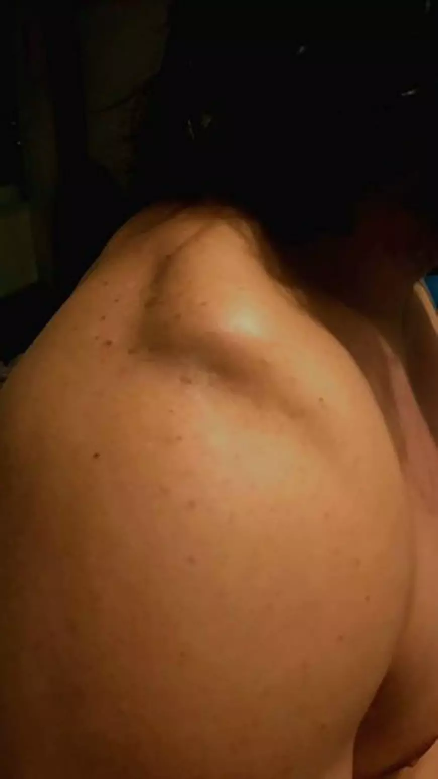 Pepe a început recuperarea după accidentul de pe pârtie: “Am dureri mari. Trebuie să facă două luni fizioterapie“