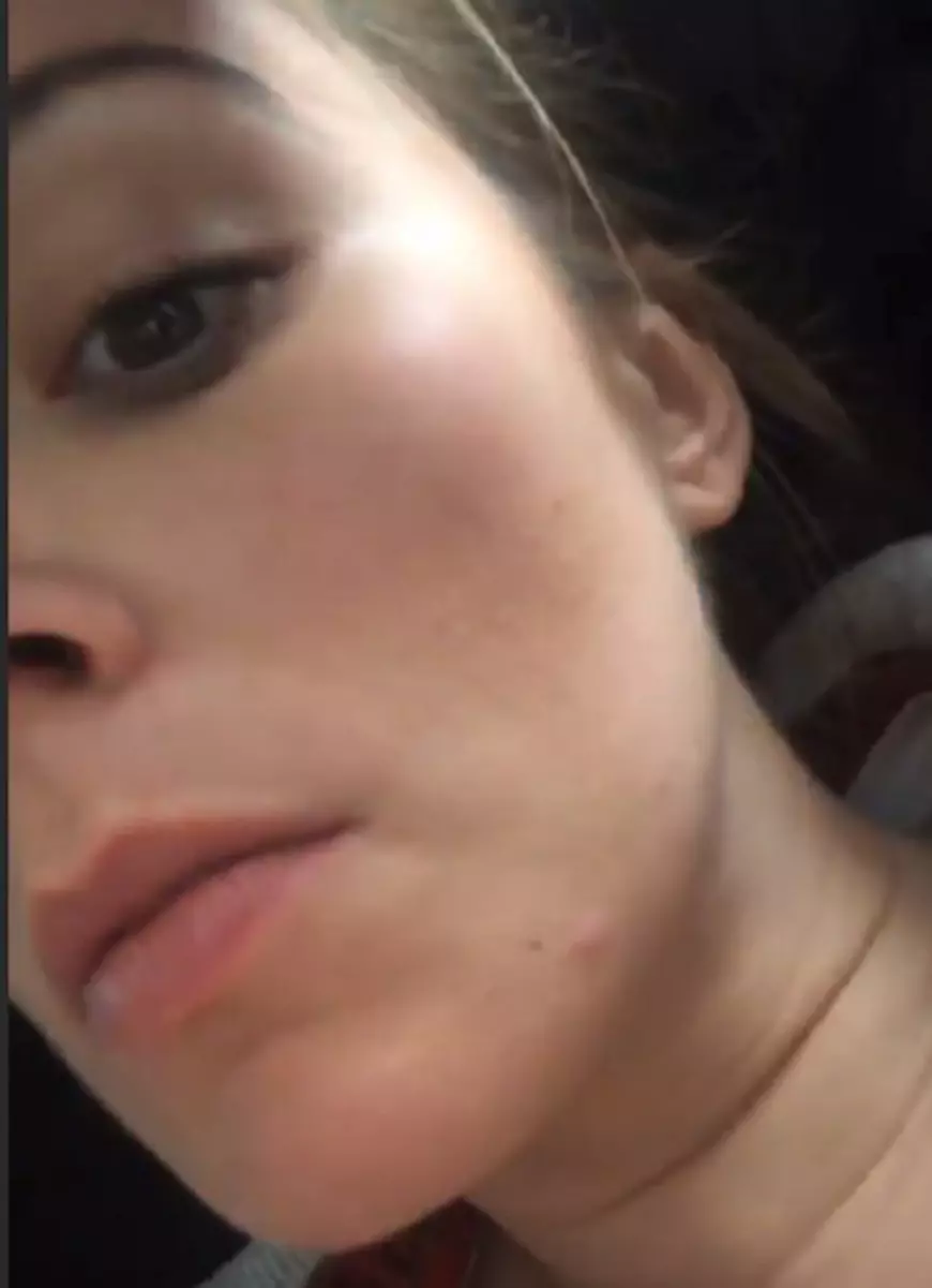 Apelul disperat făcut de Diana Dumitrescu, după ce a anunțat că este gravidă. „M-am umplut de bube. Nu mai pot ”