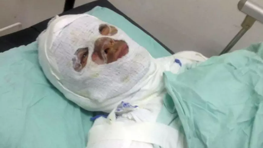 I-au dat foc unui bărbat care le-a cerut să nu se mai drogheze lângă casa lui