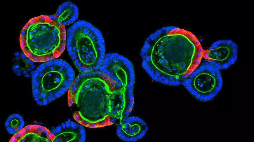 Am vizitat spitalul din Lausanne, Elveția! Cum se află cauza morții punând în funcțiune corpul după deces