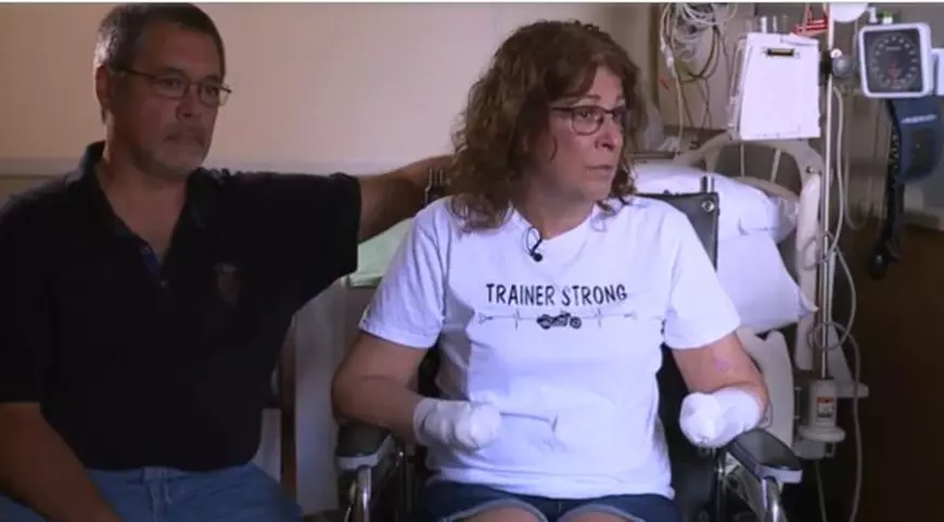 I-au amputat mâinile și picioarele unei femei după ce a luat o bacterie de la câine