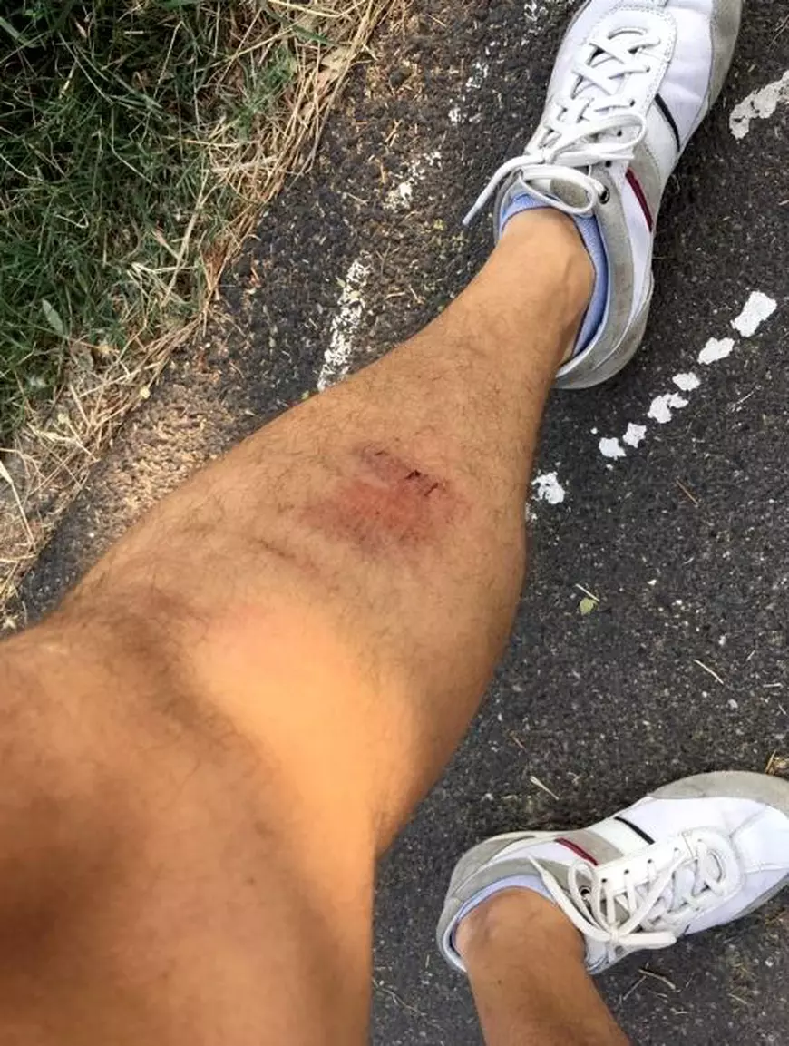 Bărbat rănit într-un capac de canal neasigurat, la Timișoara