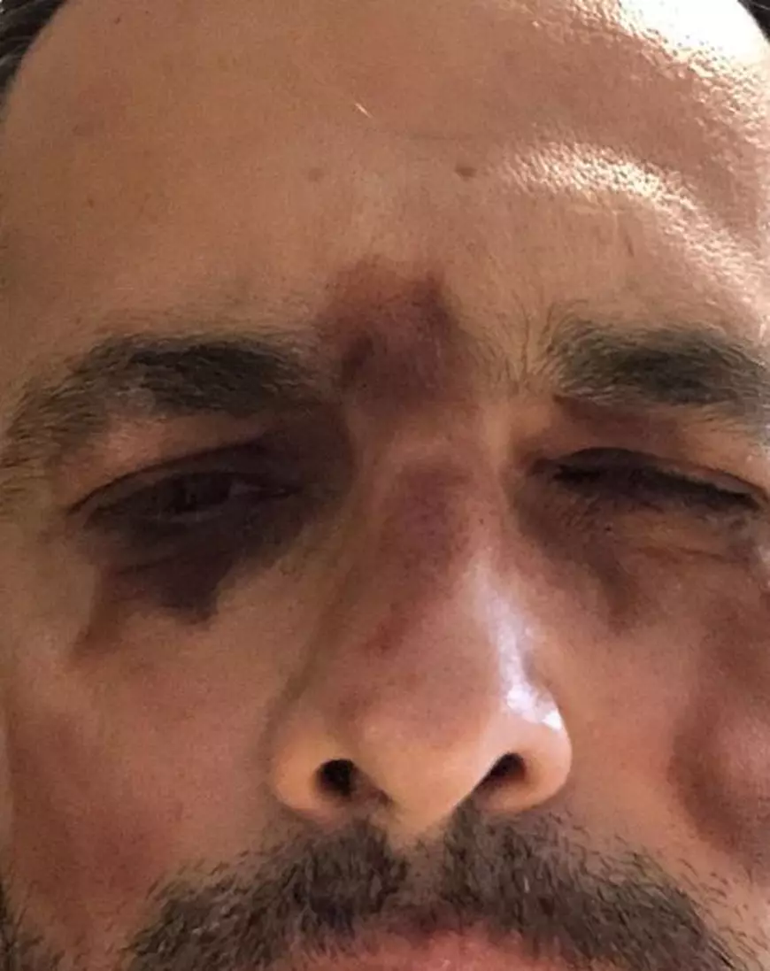 Cum apare Mădălin Ionescu în cea mai recentă poză postată pe rețelele de socializare. "Zici că am fost bătut o săptămână"