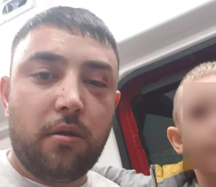 Mai mulți bodyguarzi ai afaceristului Remus Rădoi, zis Codiță, acuzați că au bătut trei persoane în Caracal. Un copil de 3 ani a ajuns la spital din cauza spray-ului iritant