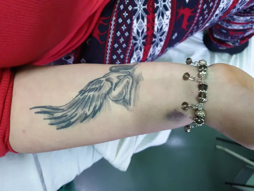 TRAGEDIA DE LA TIMIȘOARA. Femeia în cârje a ieșit din spital și cere ca administrația blocului cu proprietar elvețian să răspundă pentru ce a făcut!