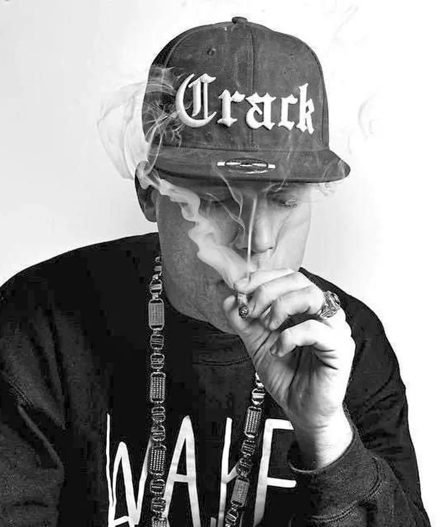 Un rapper german a rămas fără jumătate din craniu din cauza drogurilor