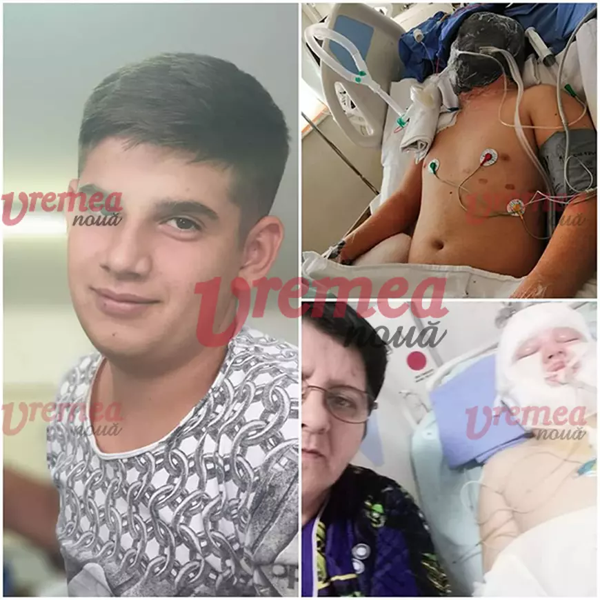 Imagini emoționante cu elevul care muncea ca să-și întrețină familia la service-ul auto ars în Huși. Robert a suferit arsuri grave pe față