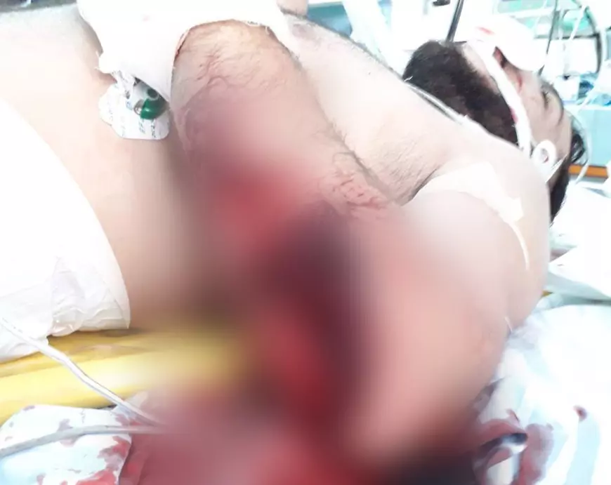 Avocații bătăușului din clanul Chira, care i-a tăiat piciorul rivalului: „Așa-zisa victimă este informatorul polițiștilor și al procurorilor”!﻿