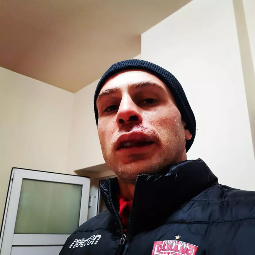 Perovici și-a pierdut doi dinți, dar își va reveni repede