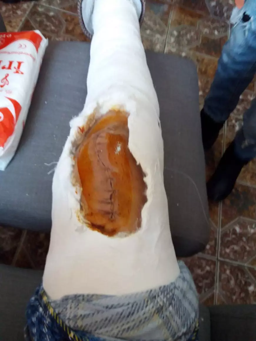 Cum a fost tărăgănat mai bine de un an dosarul unui avocat care s-a ales cu piciorul rupt după ce a reprezentat o clientă