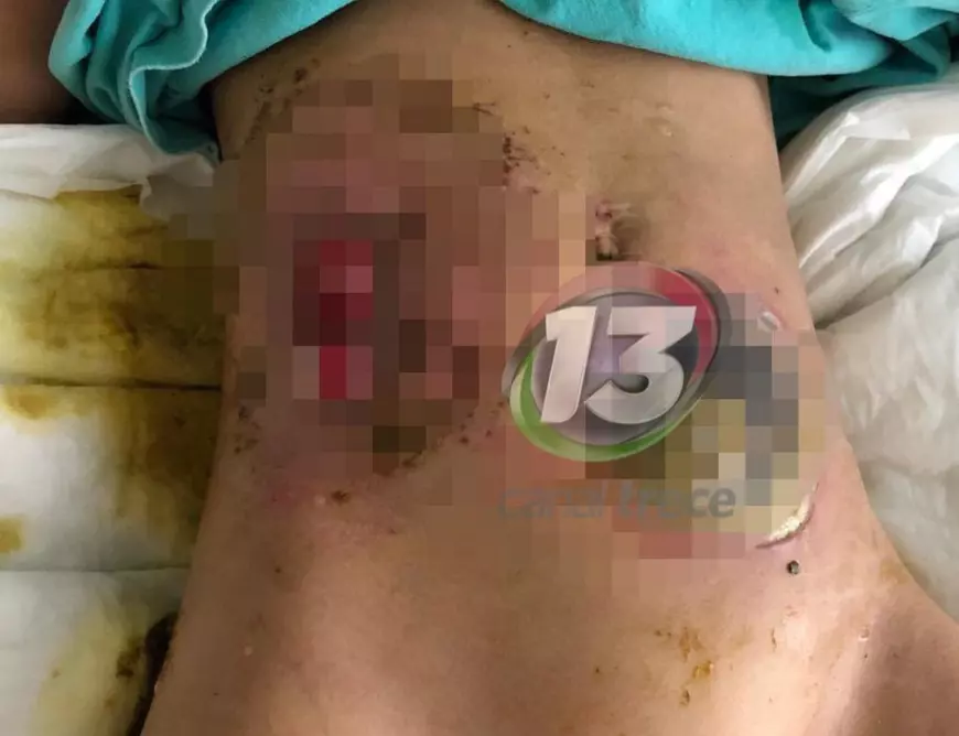 Fetiță de 7 ani moartă în spital, s-a rugat de medici să nu o facă bine, ca să nu se întoarcă acasă, la părinții ei