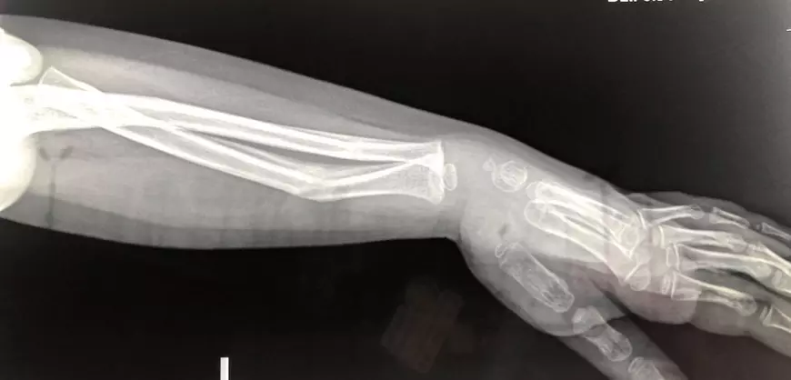 Medic condamnat după 14 mărturii de mită, acuzat de un tată: „I-a pus mâna strâmb fetiței mele de 3 ani și nici n-a vrut să stea de vorbă cu noi”