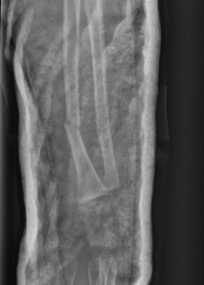 Medic condamnat după 14 mărturii de mită, acuzat de un tată: „I-a pus mâna strâmb fetiței mele de 3 ani și nici n-a vrut să stea de vorbă cu noi”