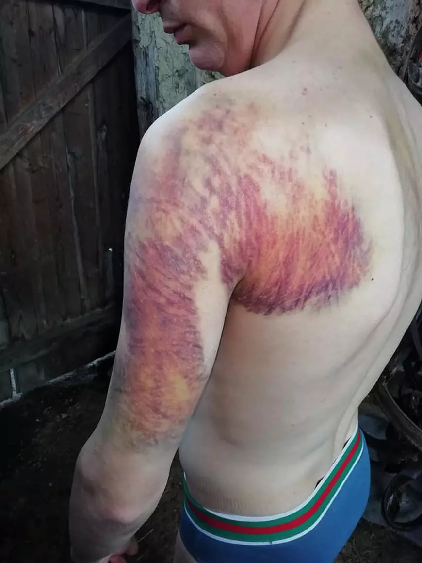 La un an după ce un tânăr susținea că a fost bătut crunt într-o secție de poliție de șeful de post, procurorii nu au stabilit agresorul