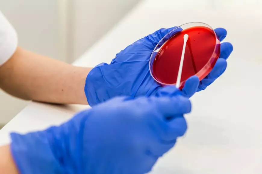 „De ce se recoltează analizele dimineața?”