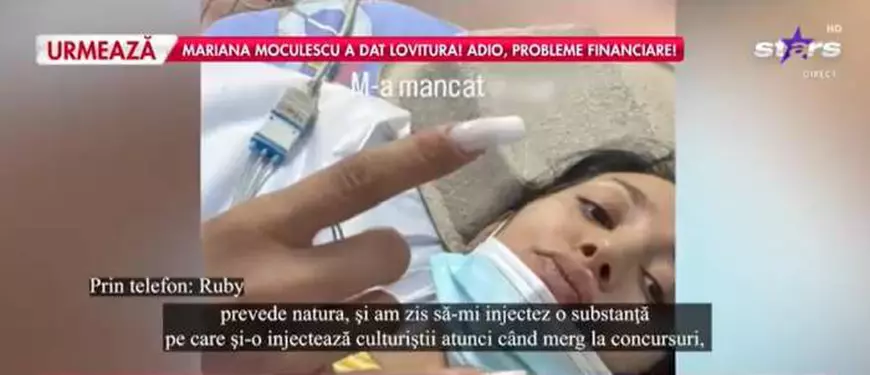 Ruby a ajuns la spital, după ce și-a injectat o substanță pe care o folosesc culturiștii. De ce a făcut artista asta. „M-a dărâmat”